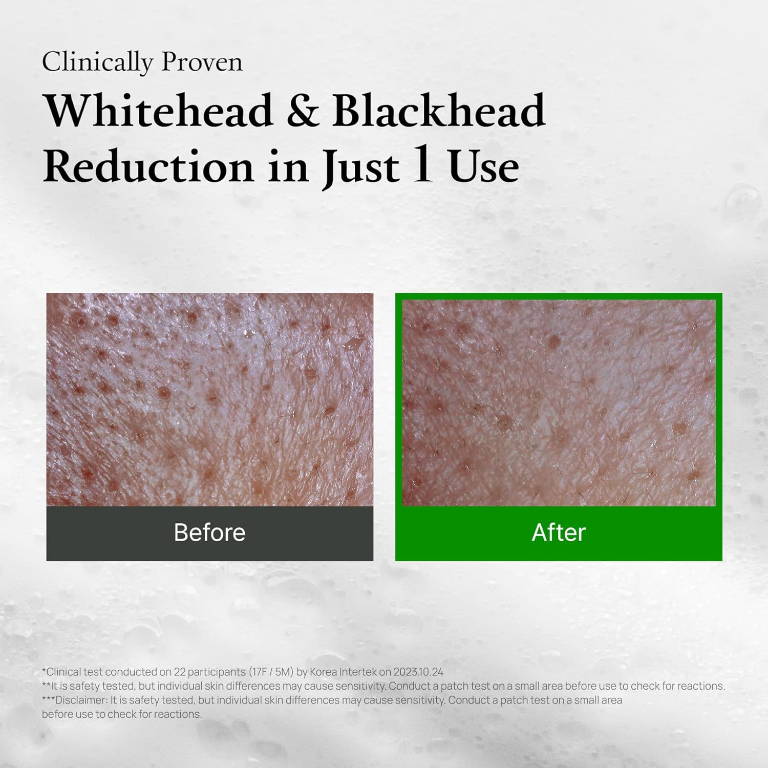 FULLY Green Tomato Pore Detox Clay Mask Cleanser, Pore Minimizing, Blackhead Care, Sebum Control, Exfoliation, Vegan, Face Wash, Sensitive Skin, Korean Skincare 120Ml