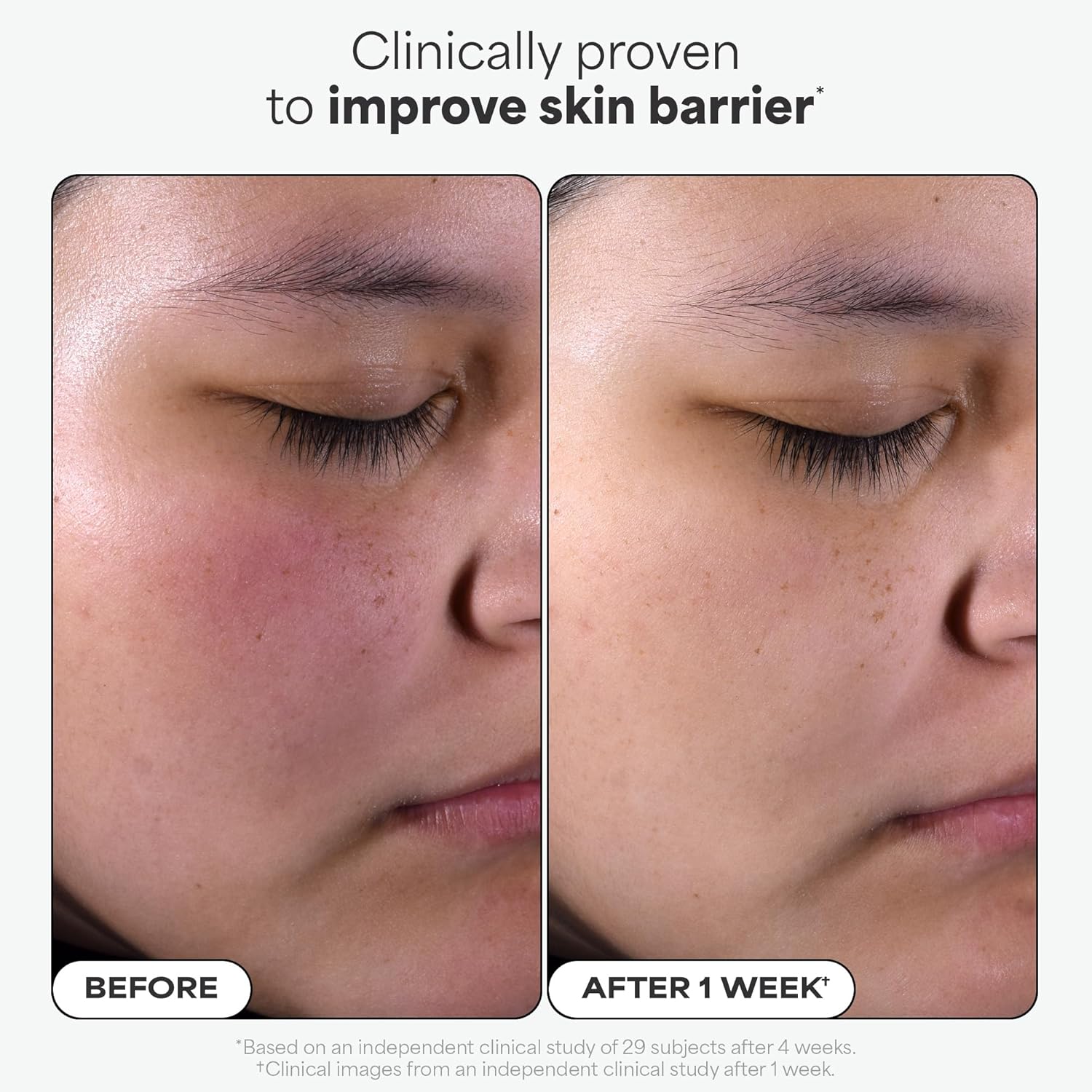 Paula'S Choice SKIN PERFECTING 2% BHA Liquid Salicylic Acid Exfoliant, Daily Facial Exfoliator for Blackheads, Enlarged Pores, Wrinkles & Fine Lines, Fragrance-Free, Full Size - 118 Ml